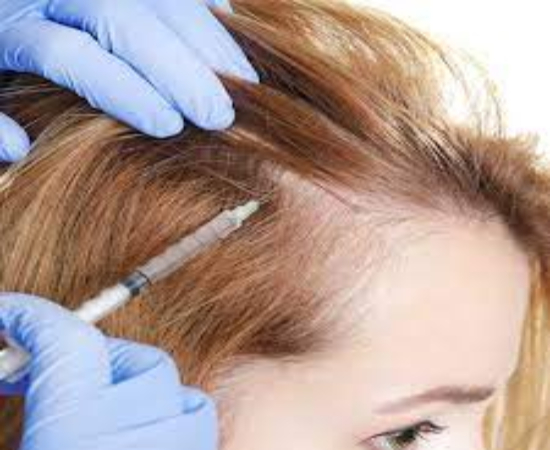 Hair Loss Treatments in hyderabad