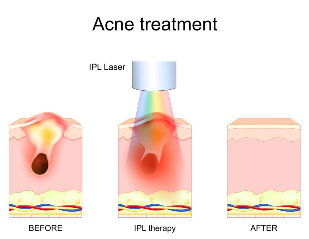 Rising skin and hair problems in Hyderabad due to sun exposure, pollution, and lifestyle stress.