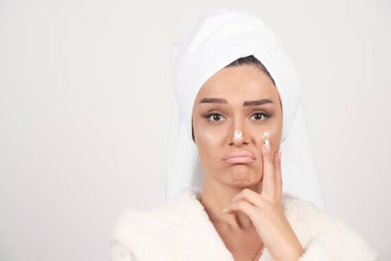 facial-pigmentation-in-indian-skin